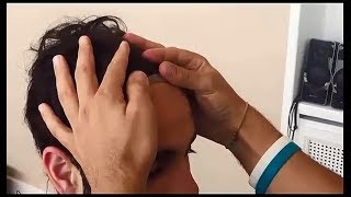 Non-Surgical Hair Transplant  - Undetectable Hair Replacement System