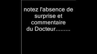 PREUVES  de complicité du Docteur Bataille dans la monstrueuse affaire \