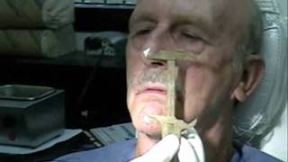 Dentures - Wax Rim Appointment - Wax esthetics, speech, CR, VDO