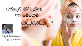 ෆේෂල්  කිරීමෙන් පසු මෙහෙම වෙනවද ?