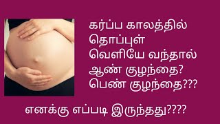 கர்ப்ப காலத்தில் தொப்புள் வெளியே தெரிந்தால் ஆண் குழந்தை? பெண் குழந்தை???