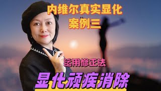 显化顽疾消除 | 内维尔真实显化案例，运用修正法，39年的背疼顽疾得以消除