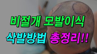 비절개 모발이식 삭발방법 총정리!!