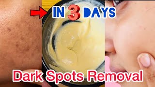 Remove Dark spots naturally in just 3 Days 🥰 Remove Hyperpigmentation, Acne Scars, Brown spots👉🏻