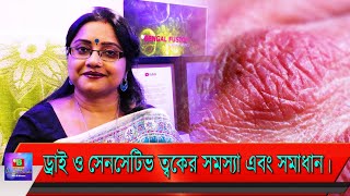 ড্রাই ও সেনসেটিভ ত্বকের সমস্যা এবং সহজ সমাধান। কি কি ঘরোয়া উপায়ে করবেন জেনে নিন। | EP 33