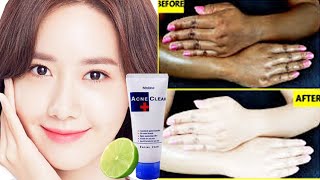 Get Fair Skin Quickly Naturally | ស្បែកសខ្ចីបាត់ស្នាមលឿន| Get Clear and Fair Skin Fast