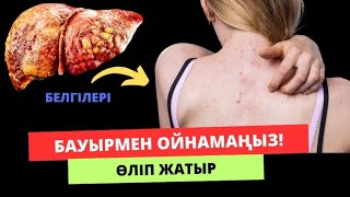 Бауырыңыздың өліп жатқанының белгілері. Бауырда  проблемалары бар 90% адам білмейді. Бауыр ауруы.