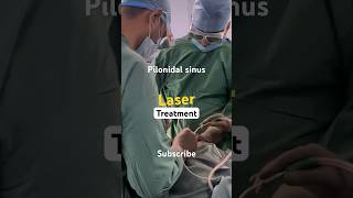 How LASER treatment for Pilonidal Sinus surgery ? Steps for operation ?