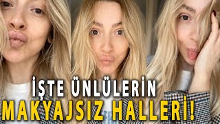 İŞTE ÜNLÜLERİN MAKYAJSIZ HALLERİ!