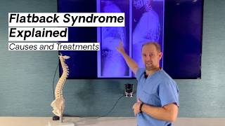 Flatback Syndrome Explained by a Spine Surgeon | VSI