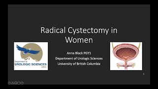 Radical Cystectomy in Women