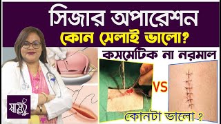 সিজার অপারেশনে কোন সেলাই ভালো! - সিজারে কসমেটিক নাকি নরমাল সেলাই? - Normal Vs Cosmetics Suturing