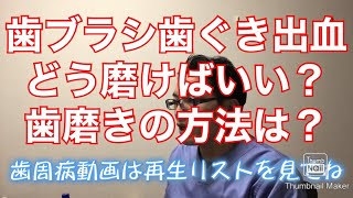 歯周病の歯茎の出血 歯磨き方法　動画７７ 口臭　歯茎　歯肉　歯医者　歯石取りクリーニング予防歯科　大宮駅西口　鈴木歯科医院　デンタル歯科クリニック