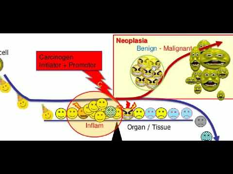 Neoplasia 1 Basics Pathology Lectures Youtube