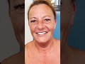 meet ebony our delighted patient from the uk dentist dentistry smilemakeover dentalhealth