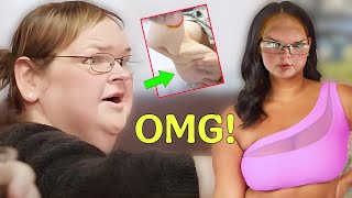 Doctors Reject Tammy’s Skin Removal Surgery Request As She Confesses To Vaping Multiple Times A Day!