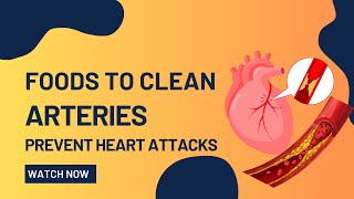 🔴Top 10 Foods to Unclog Arteries Naturally and Prevent Heart Attacks