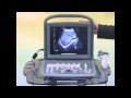 All you need to know about Chison ECO1 human or vet Ultrasound why it is good to buy it