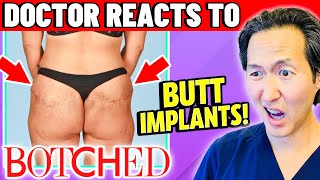 Plastic Surgeon Reacts to BOTCHED: BUTT Implants GONE WRONG!