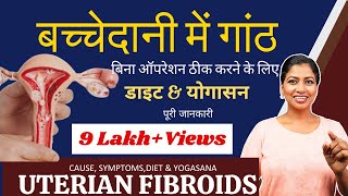 बच्चेदानी में गांठ को ठीक करने के लिए योग और डाइट Yoga for Uterine Fibroids PCOD@yogawithshaheeda