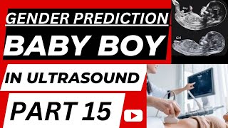 Baby Boy In Ultrasound  | A Clear Footage | of Male Baby