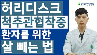 비만인 허리디스크, 협착증 환자가 살을 빼면 증상 개선에 많은 도움이 됩니다