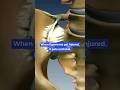Stabilizing the SI Joint prevents inflammation