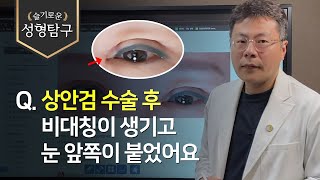 Q. 앞트임, 눈매교정 재수술인데, 눈 앞쪽이 붙어버렸어요