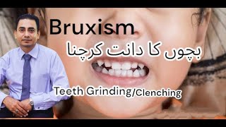 Bachon Ka Dant Krichna || Bruxism || Teeth Grinding/ Cleenching ||بچوں کا دانت کرچنا