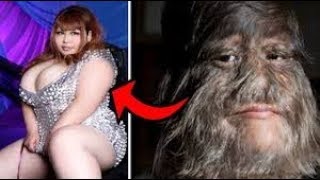 Dünyanın En Kıllı Kızını Hatırlıyor Musun ? Bugün Nasıl Olduğuna İnanamayacaksın..!