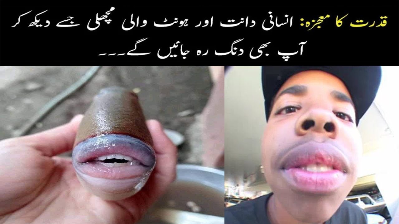 Human Lips And Teeth Fish Lipstutorial Org