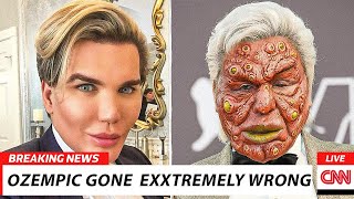 10 Shocking Celebrity Ozempic Transformations that backfired 2025