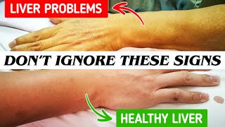 DON'T IGNORE These 10 Health SIGNS Your Body Is Warning You About