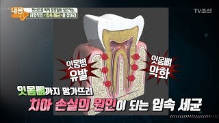 암, 치매는 입속에서 시작된다?! [내 몸 사용설명서] 187회 20180112