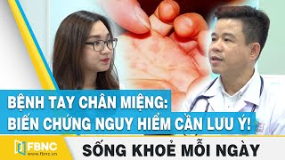 Bệnh tay chân miệng: Dấu hiệu nhận biết và cách điều trị, bác sỹ Dư Tuấn Quy | FBNC