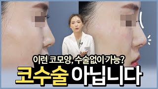 10분만에 이런 코모양 가능?! 👃코필러 고민중이시면 이 영상 시청하세요ㅣ필러+실 복합시술ㅣ효과, 용량, 주의사항