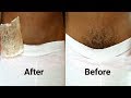 STOP SHAVING!! PROPER WAY TO REMOVE PUBIC HAIR WITHOUT SHAVING STOP SHAVING!! PROPER WAY TO REMOVE PUBIC HAIR WITHOUT SHAVING