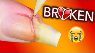 MY LIFE IS OVER I AM BROKEN / Fixing my broken nail