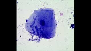 Cheek Epithelial Cells: How to Prepare a Wet Mount Microscope Slide