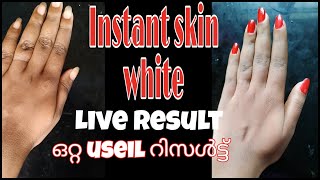 |Instant skin whitening LIVE RESULT| ഒറ്റ തവണ ഉപയോഗിച്ചാൽ തന്നെ റിസൾട്ട്‌ കിട്ടും |