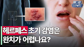 헤르페스 초기 감염은 완치가 어렵나요?ㅣ메디컬 인사이트[21회] / YTN2