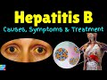 Hepatitis B – Symptoms, Causes, Risk Factors, Pathophysiology, Diagnosis, Treatment