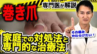 【巻き爪治療実践】巻き爪 治療 の全て！ワイヤー 矯正 と原因 から考える効果的な治し方