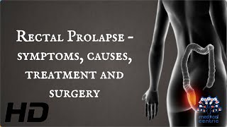 Rectal Prolapse – Symptoms, Causes, Treatment And Surgery