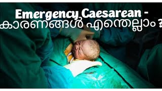 Reasons for Emergency Caesarean Section (LSCS)