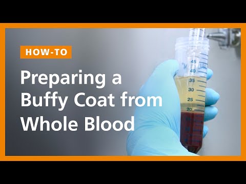 What is the buffy coat found in centrifuged whole blood quizlet?