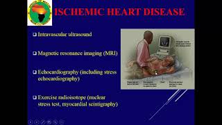 ISCHEMIC HEART DISEASE   Part 2