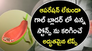 Gallbladder Stone Removal | GallStones Telugu | Gallbladder Symptoms | Dr. Arun | RedTv Health