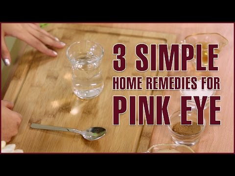 3 Simple Natural Home Remedies For PINK EYE TREATMENT 3 Simple Natural Home Remedies For PINK EYE TREATMENT