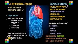 NCLEX Review on the Gastro Diseases Chrons, Ulcerative